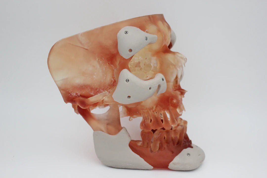 Transforming Surgical Skills: The Benefits of 3D Models - SurgiSim