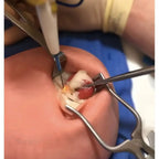 Ultrasound biopsy simulator
