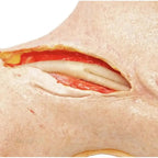 Endarterectomy training model UK