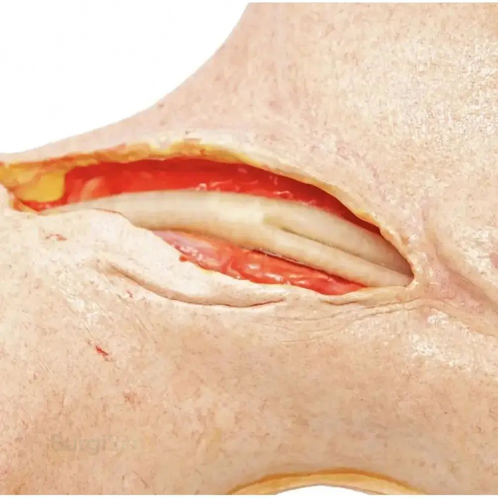 Endarterectomy training model UK