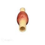 Ectopic Pregnancy Model | OB - GYN Surgical Training Simulator - Obstetrics, Gynecology & OB/GYN Surgical Simulation Training Models