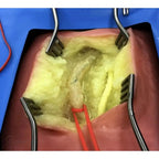 Femoral Endarterectomy & Groin Dissection Training Simulator - Vascular Surgery & Anastomosis Surgical Training Models