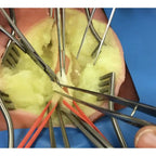 Vascular Surgery & Anastomosis Surgical Training Models