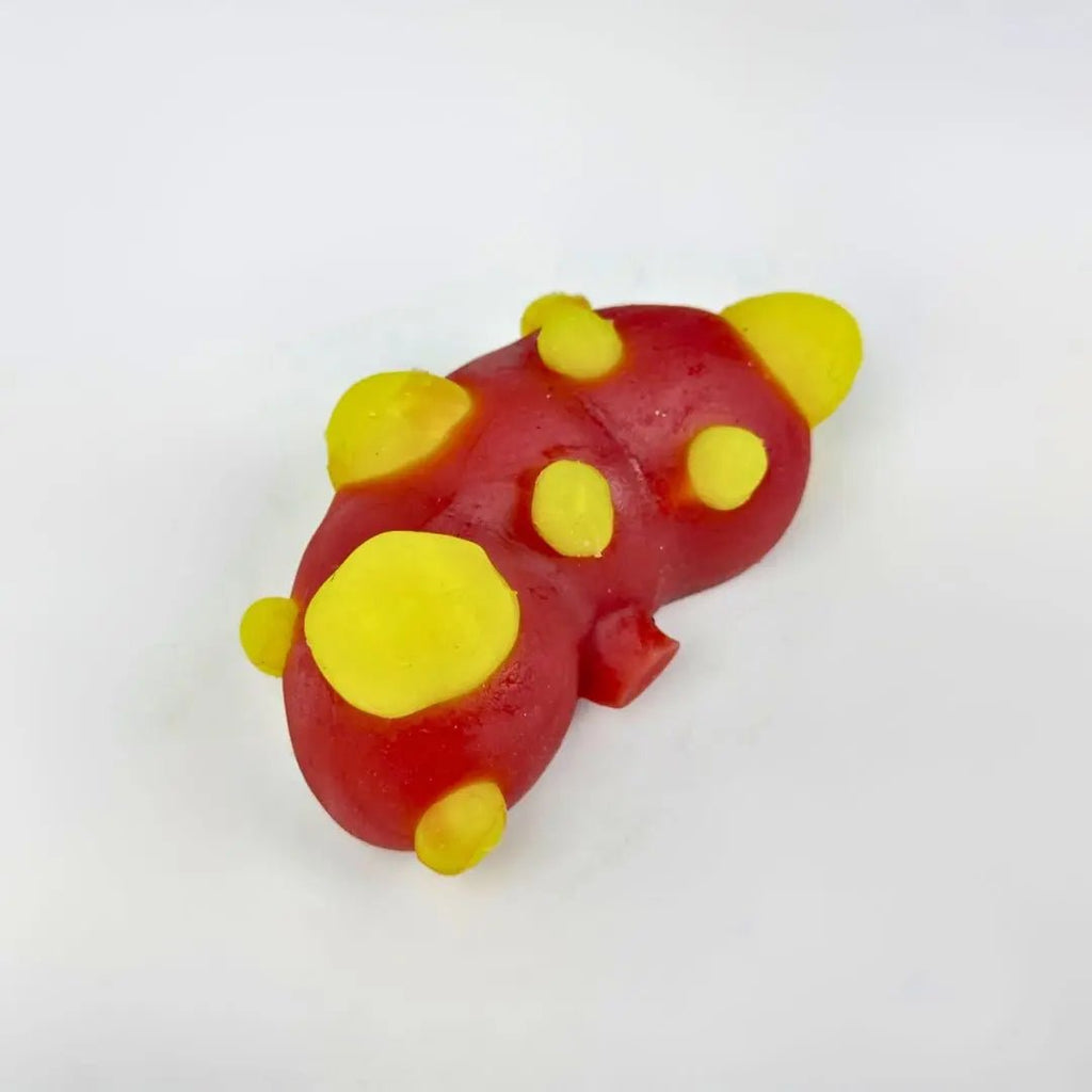 Kidney Cancer Anatomical Training Model - Urology