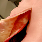 LifeLike AAA Abdomen Simulator - Advanced Surgical Simulation