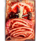 LifeLike AAA Abdomen Simulator - Advanced Surgical Simulation