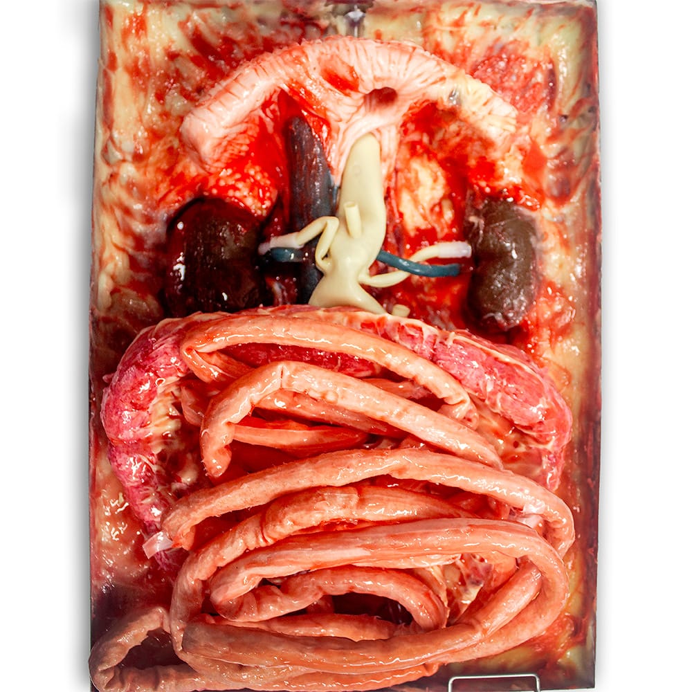LifeLike AAA Abdomen Simulator - Advanced Surgical Simulation