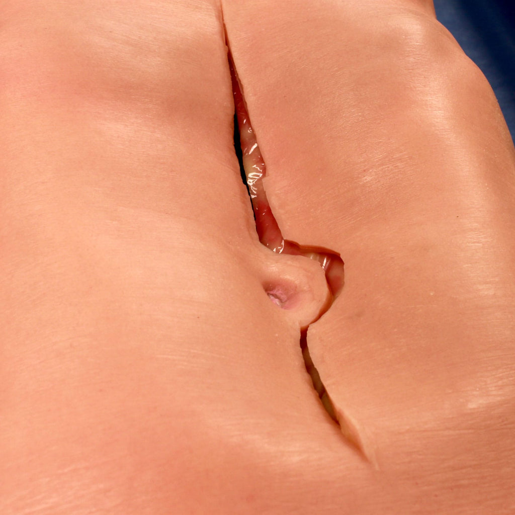 LifeLike AAA Abdomen Simulator - Advanced Surgical Simulation