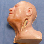 LifeLike Abdominal Aorta Model – Aortoiliac Bypass Training Simulator - Vascular Surgery Training