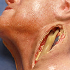 LifeLike Abdominal Aorta Model – Aortoiliac Bypass Training Simulator - Vascular Surgery Training
