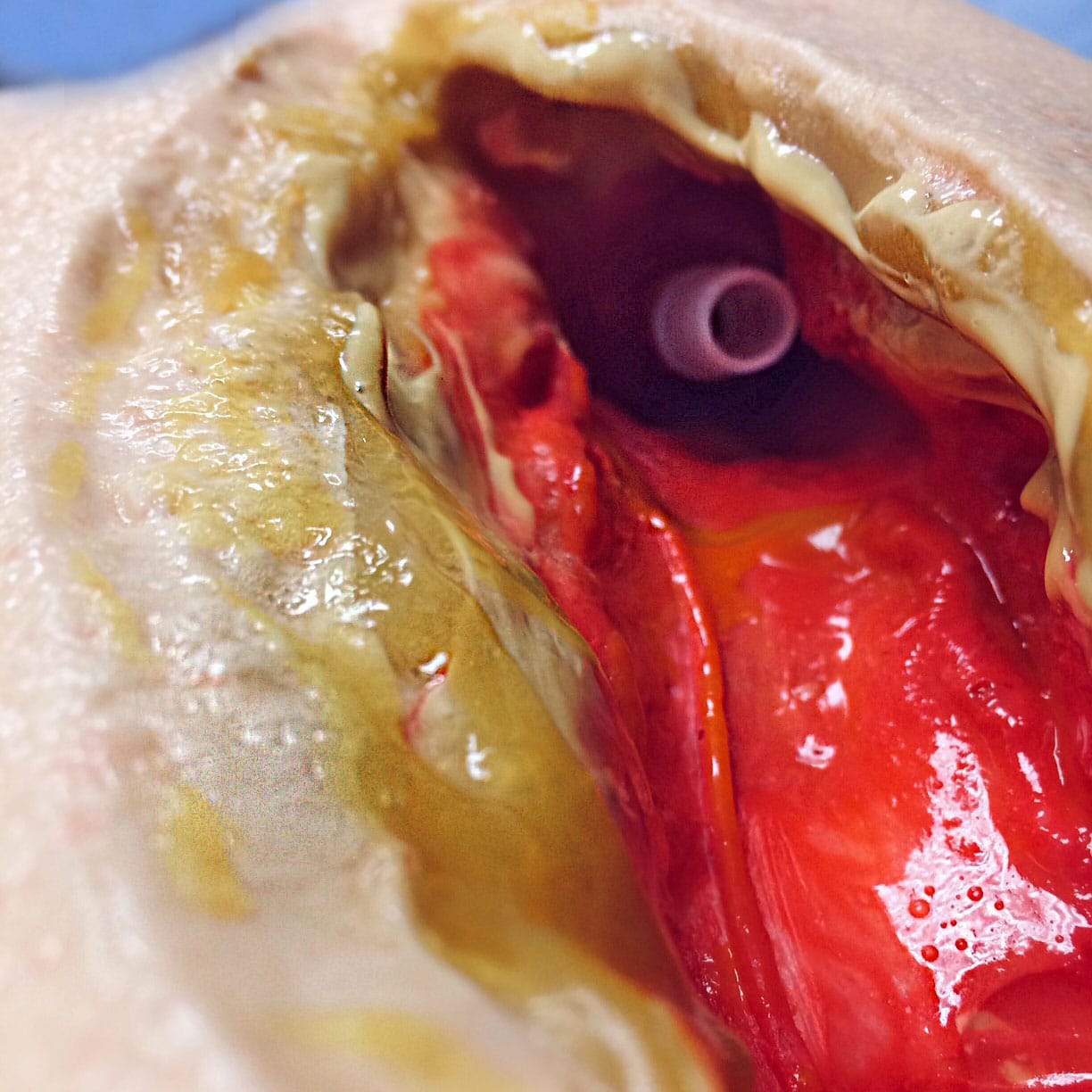 LifeLike BioTissue Femoral Leg Simulator - Advanced Surgical Simulation