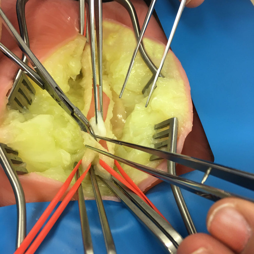 LifeLike Embedded Femoral Groin Model – Endarterectomy Simulator - Vascular Surgery Training