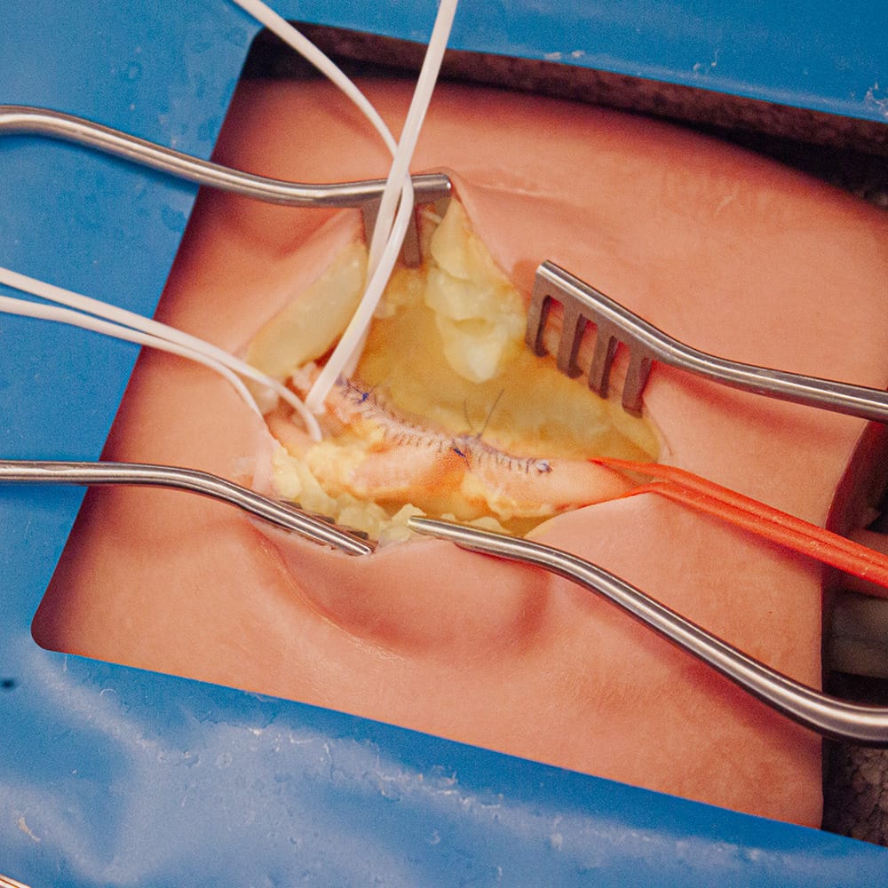 LifeLike Embedded Femoral Groin Model – Endarterectomy Simulator - Vascular Surgery Training
