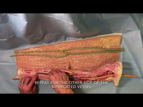 LifeLike Shunt Arm Simulator