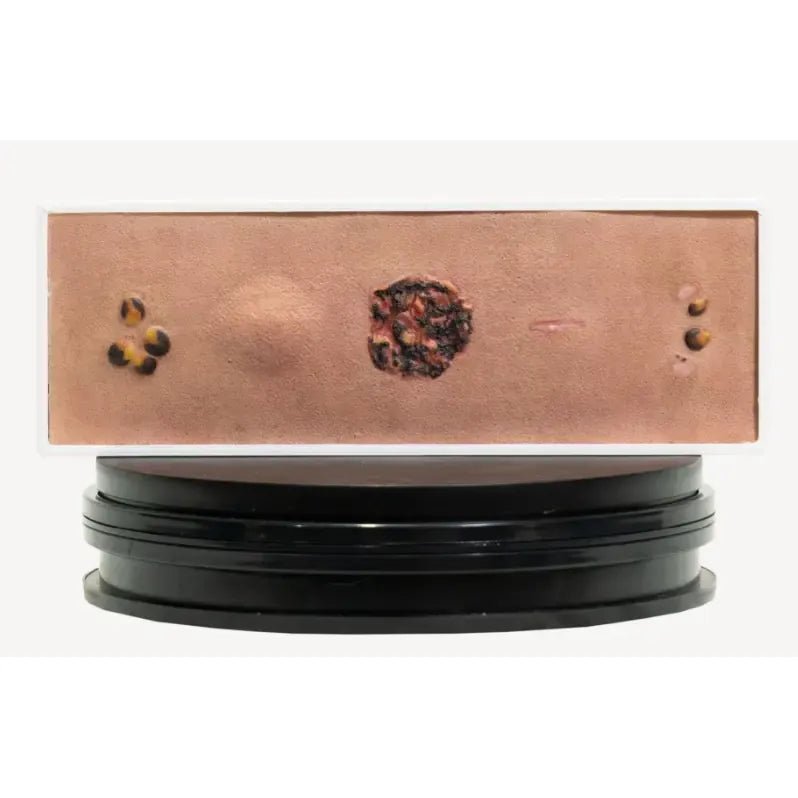 Simulator of Cancerous lesions - Medical Aesthetics