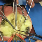 VI Box Surgical Simulator | Vascular & Surgical Skills Training System - Vascular Surgery & Anastomosis Surgical Training Models